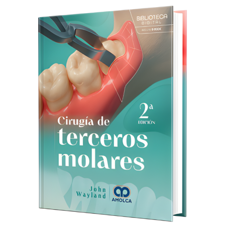 Cirugía de terceros molares