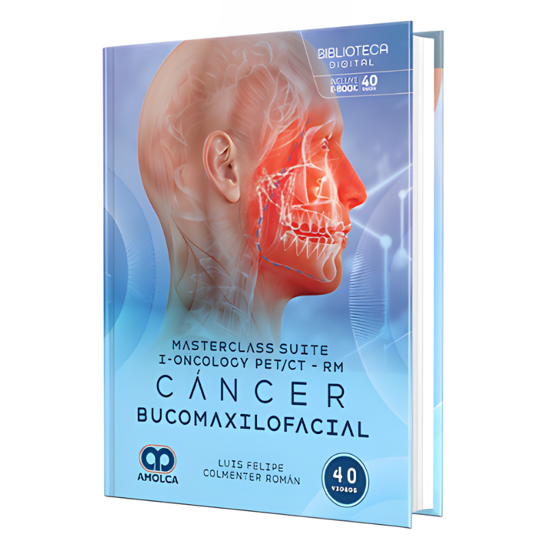 Masterclass suite i-Oncology PET/CT-RM. Cáncer bucomaxilofacial