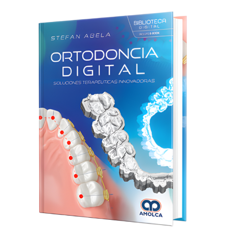Ortodoncia digital. Soluciones terapéuticas innovadoras
