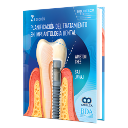 Planificación del tratamiento en implantología dental