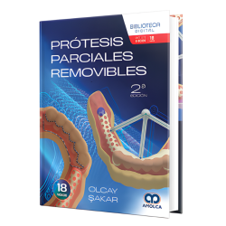 Prótesis parciales removibles