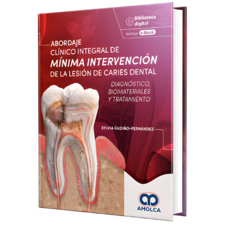 Abordaje Clínico Integral de Mínima Intervención de la Lesión de Caries Dental