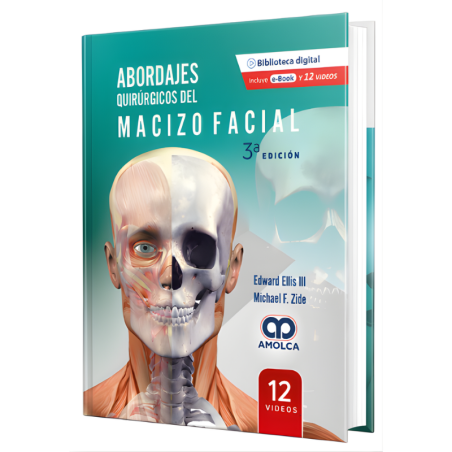 Abordajes Quirúrgicos del Macizo Facial. 3a Edición