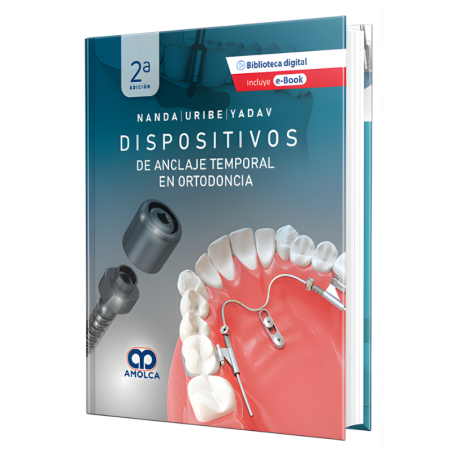 Dispositivos de Anclaje Temporal en Ortodoncia - 2ª Edición