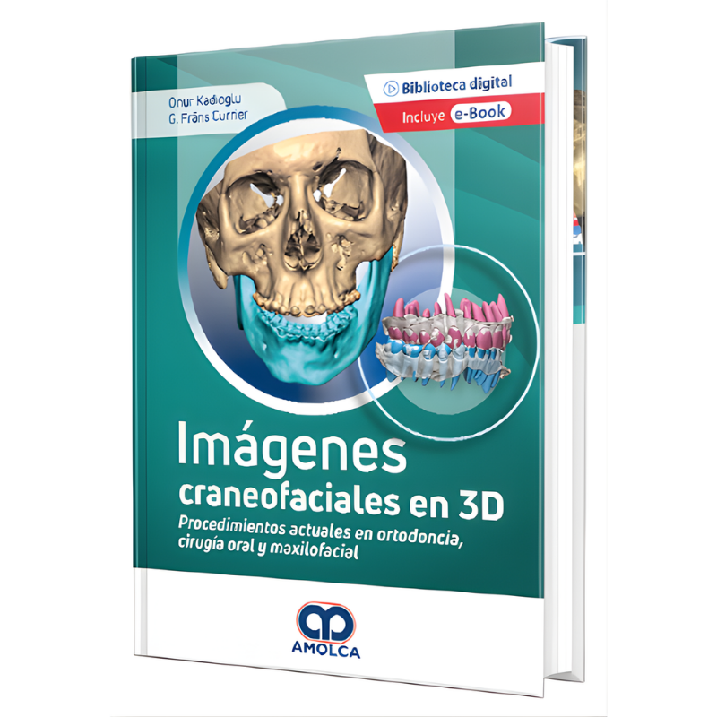 Imágenes Craneofaciales en 3D - Onur Kadioglu