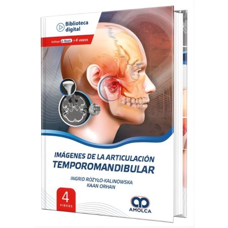Imágenes de la Articulación Temporomandibular