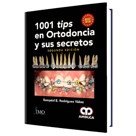 1001 tips en Ortodoncia y sus Secretos 2 Edición