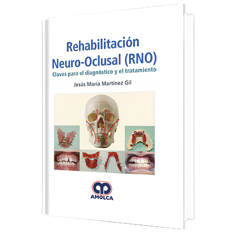 Rehabilitación Neuro-Oclusal (RNO)